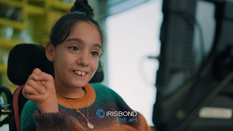 IRISBOND